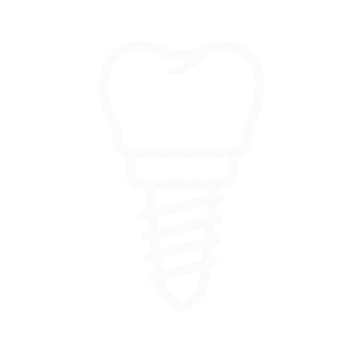 Implantes Dentários